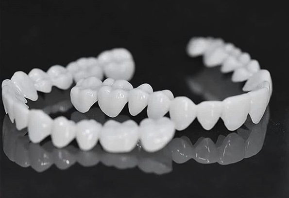 Smile Lens – Verstelbare Witte Tandprothese voor Directe Glimlachcorrectie