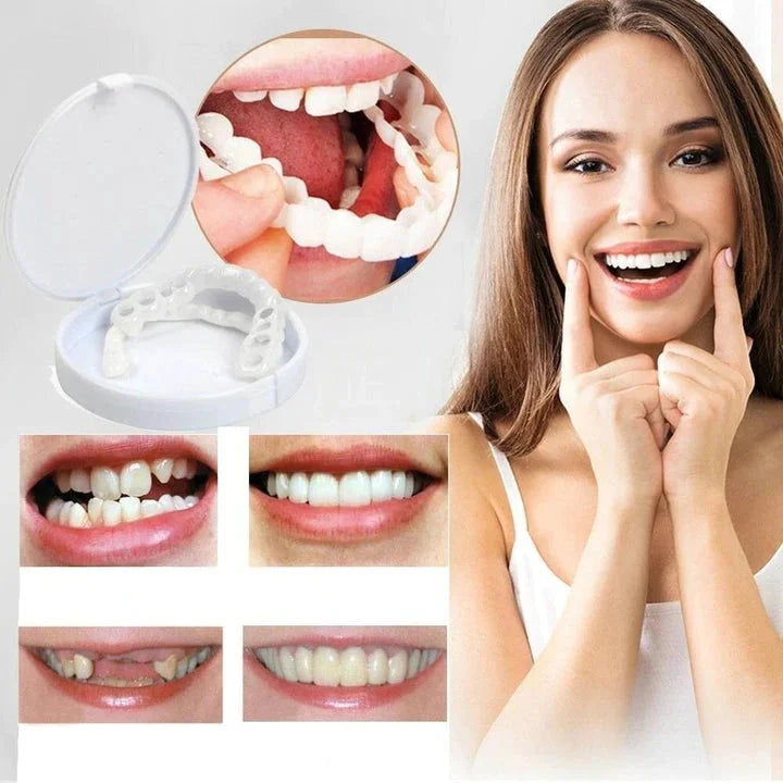 TandVorm Snap-On Tanden Veneers – Directe Glimlach Correctie voor Onregelmatige of Ontbrekende Tanden