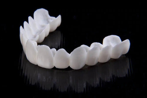 Smile Lens – Verstelbare Witte Tandprothese voor Directe Glimlachcorrectie
