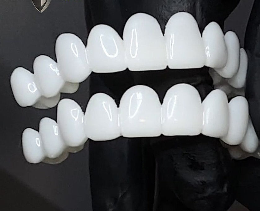 Smile Lens – Verstelbare Witte Tandprothese voor Directe Glimlachcorrectie