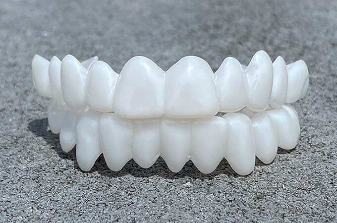 Smile Lens – Verstelbare Witte Tandprothese voor Directe Glimlachcorrectie