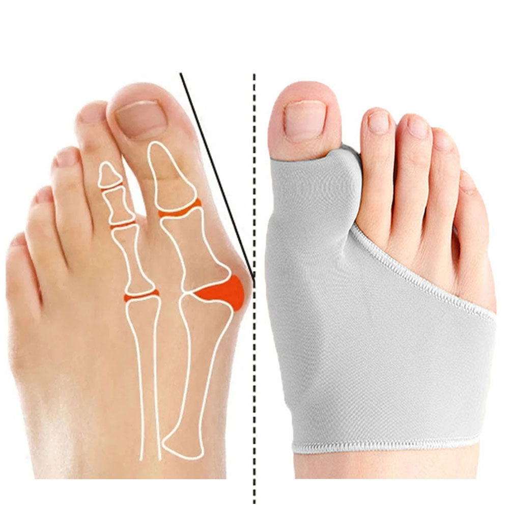 OrthoFix - Bunion Correctie - Teenseparator - Gelpad voetpijn corrector