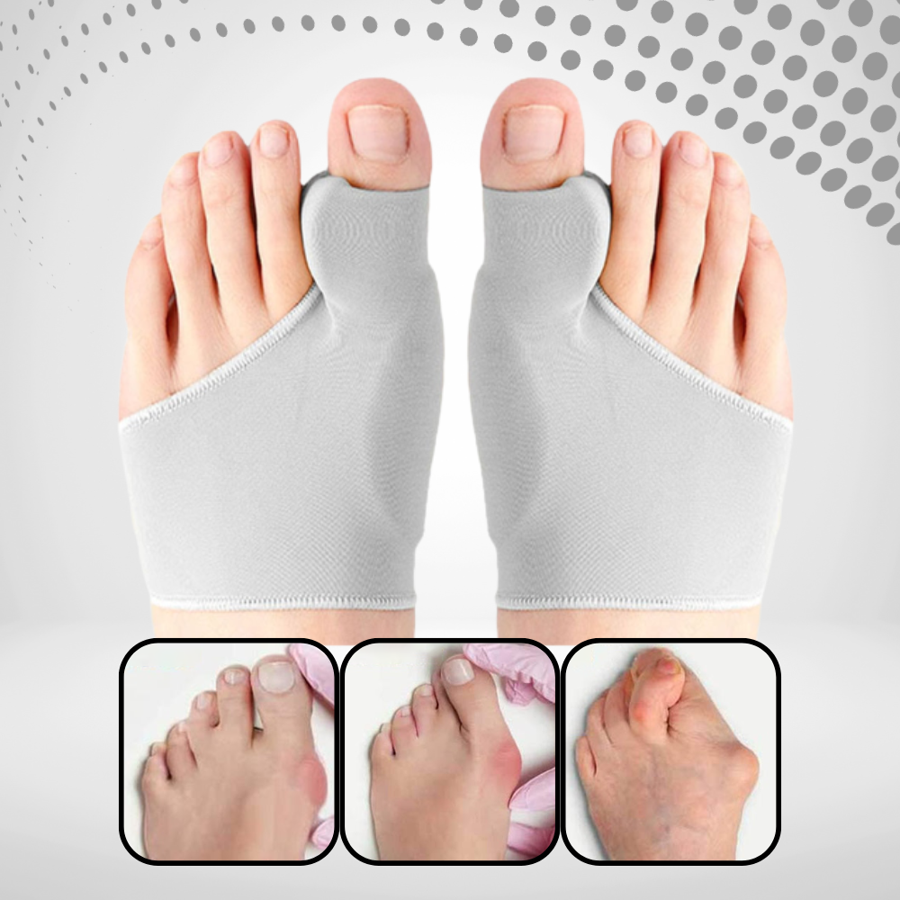 OrthoFix - Bunion Correctie - Teenseparator - Gelpad voetpijn corrector