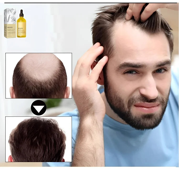 PW | Rozemarijn Haar Serum