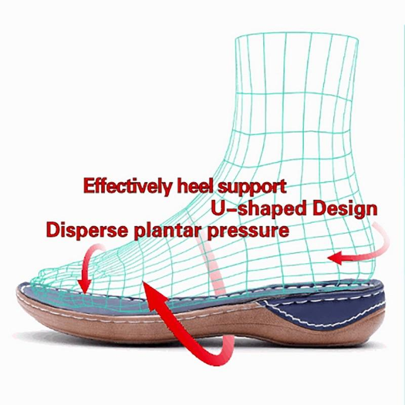 ComfortLuxe Ballerina’s – Orthopedische Damesschoenen voor Hallux Valgus met Ademend Mesh