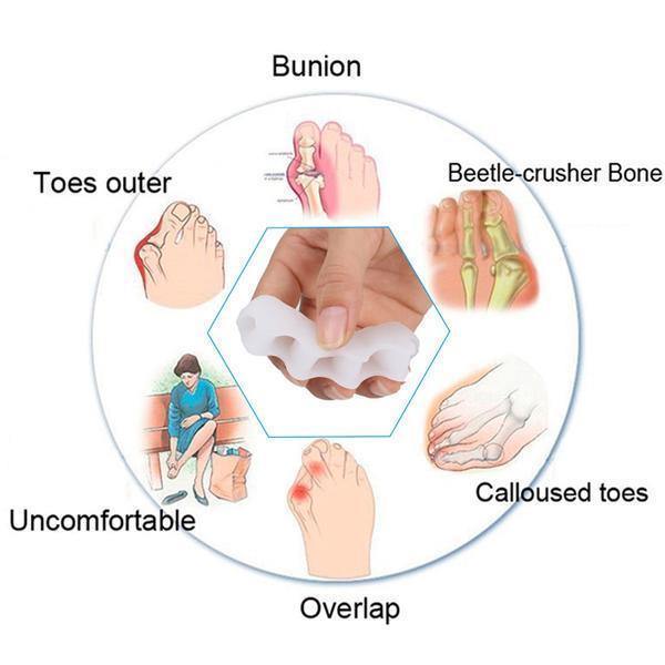 TeenHerstel | Orthopedische Hallux- en Hamertenen Corrector met Teenspreider