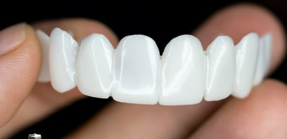 Cosmetische Tandtoppers SmileVorm – Herbruikbaar, Flexibel en Natuurlijk Wit