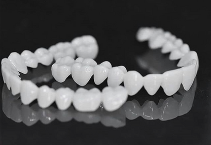 Smile Lens – Verstelbare Witte Tandprothese voor Directe Glimlachcorrectie