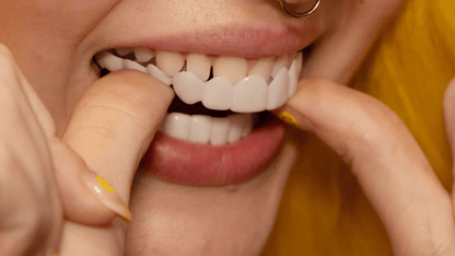 TandVorm Snap-On Tanden Veneers – Directe Glimlach Correctie voor Onregelmatige of Ontbrekende Tanden