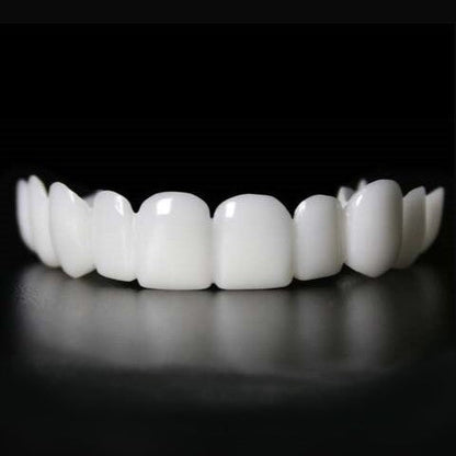 TandVorm Snap-On Tanden Veneers – Directe Glimlach Correctie voor Onregelmatige of Ontbrekende Tanden