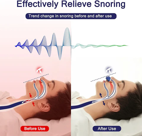 Draagbaar Micro CPAP-apparaat | Anti-Snurkoplossing voor Reizen