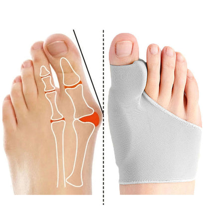 OrthoFix - Bunion Correctie - Teenseparator - Gelpad voetpijn corrector
