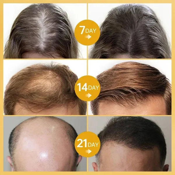 PW | Rozemarijn Haar Serum