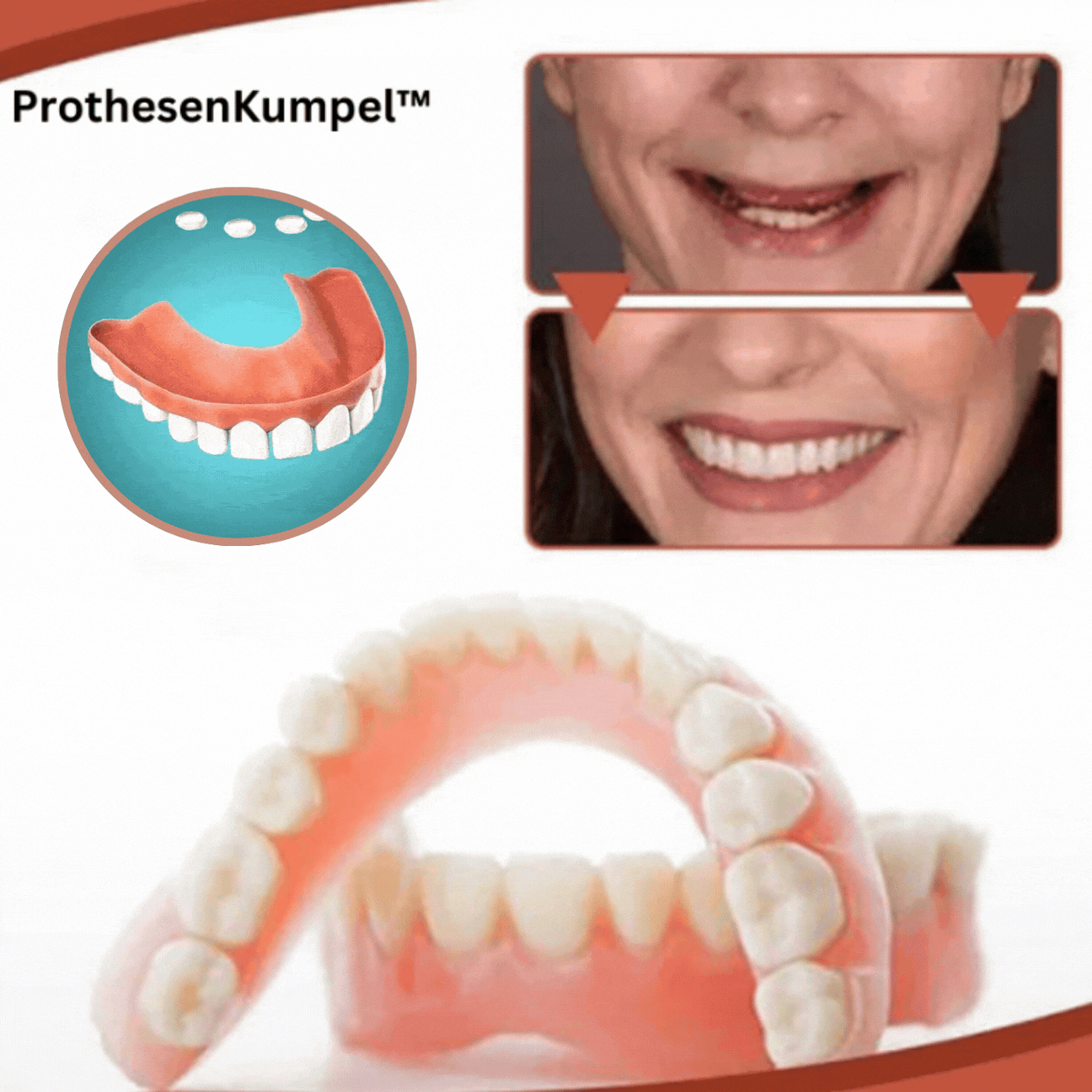 Siliconen Prothese Comfort Aanpassingsset - Stabiele Pasvorm voor Kunstgebit