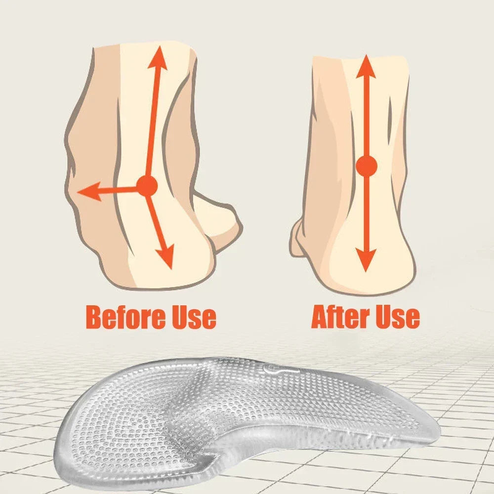 Siliconen Gel Voetzolen met Gewelfondersteuning - Comfort en Stabiliteit