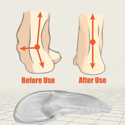 Siliconen Gel Voetzolen met Gewelfondersteuning - Comfort en Stabiliteit