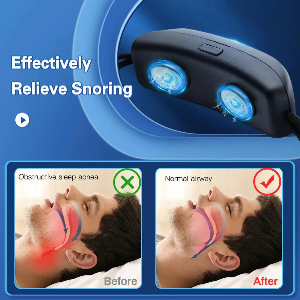 Slimme Anti-Snurkapparaat EMS Pulse Stop Snore Effectieve Hulp bij Snurkenpreventie