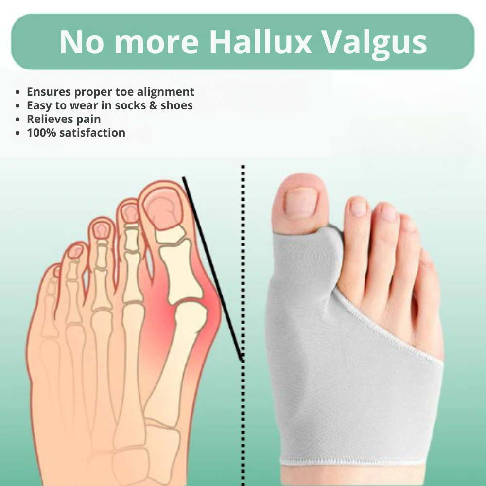 FlexiToe Corrector – Comfortabele Hallux Valgus Teenbrace voor Dagelijks Gebruik