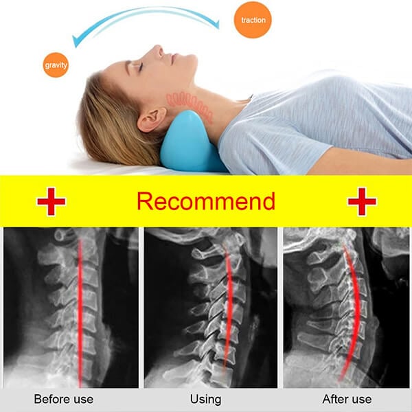 NeckEase Stretch – Ergonomisch Nekkussen voor Nekontspanning