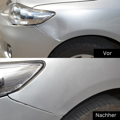 DeukFix Reparatieset – Auto Deuken Verwijderen Zonder Lakschade