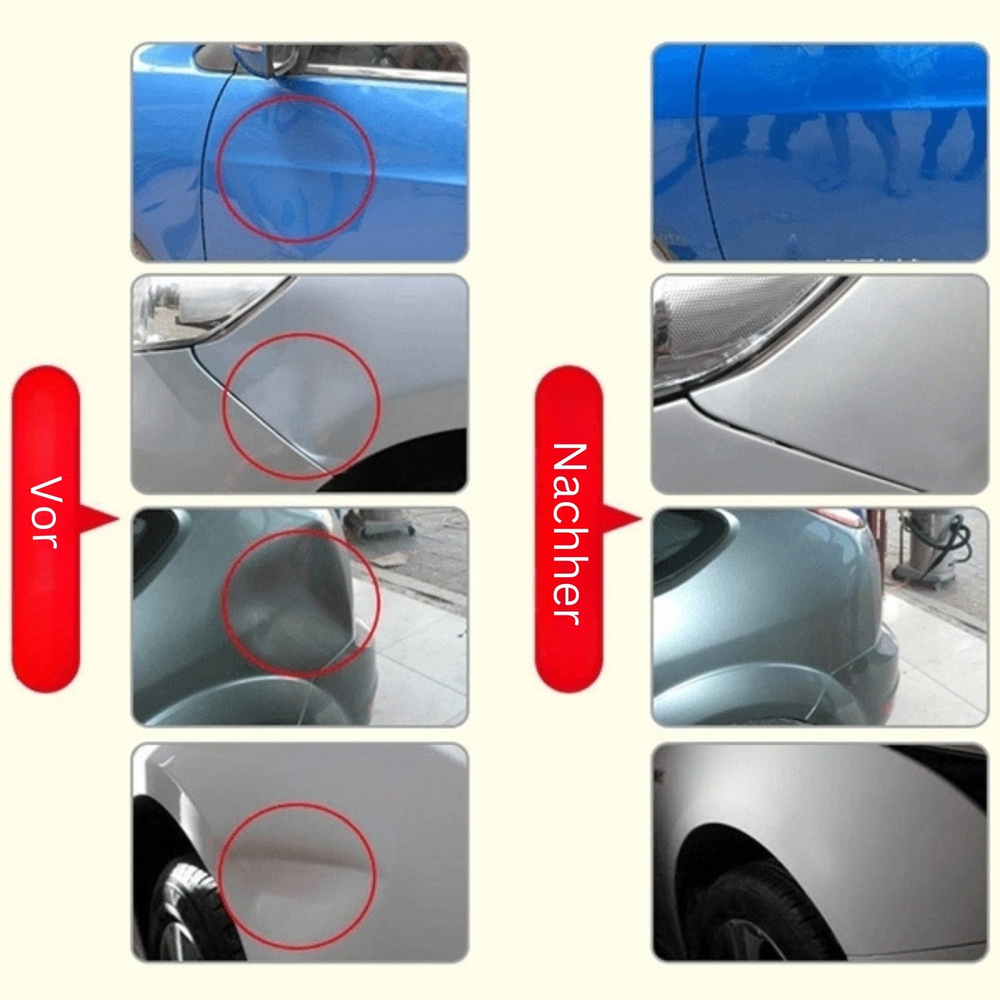 DeukFix Reparatieset – Auto Deuken Verwijderen Zonder Lakschade