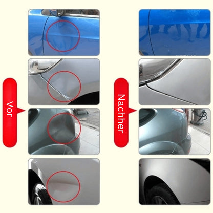 DeukFix Reparatieset – Auto Deuken Verwijderen Zonder Lakschade
