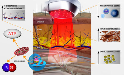 Draagbaar Roodlichttherapie Apparaat met 808nm & 650nm voor Pijnverlichting en Herstel