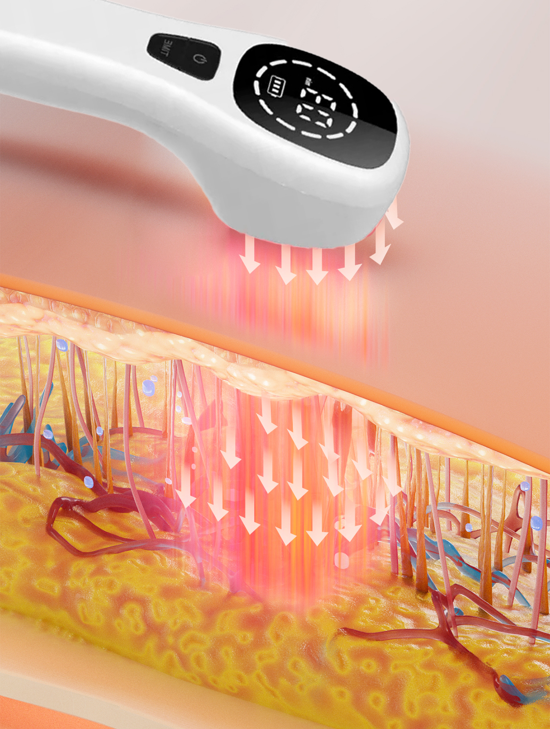 Draagbaar Roodlichttherapie Apparaat met 808nm & 650nm voor Pijnverlichting en Herstel